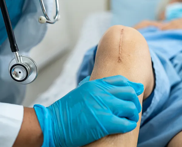 Best Knee Joint Preservation